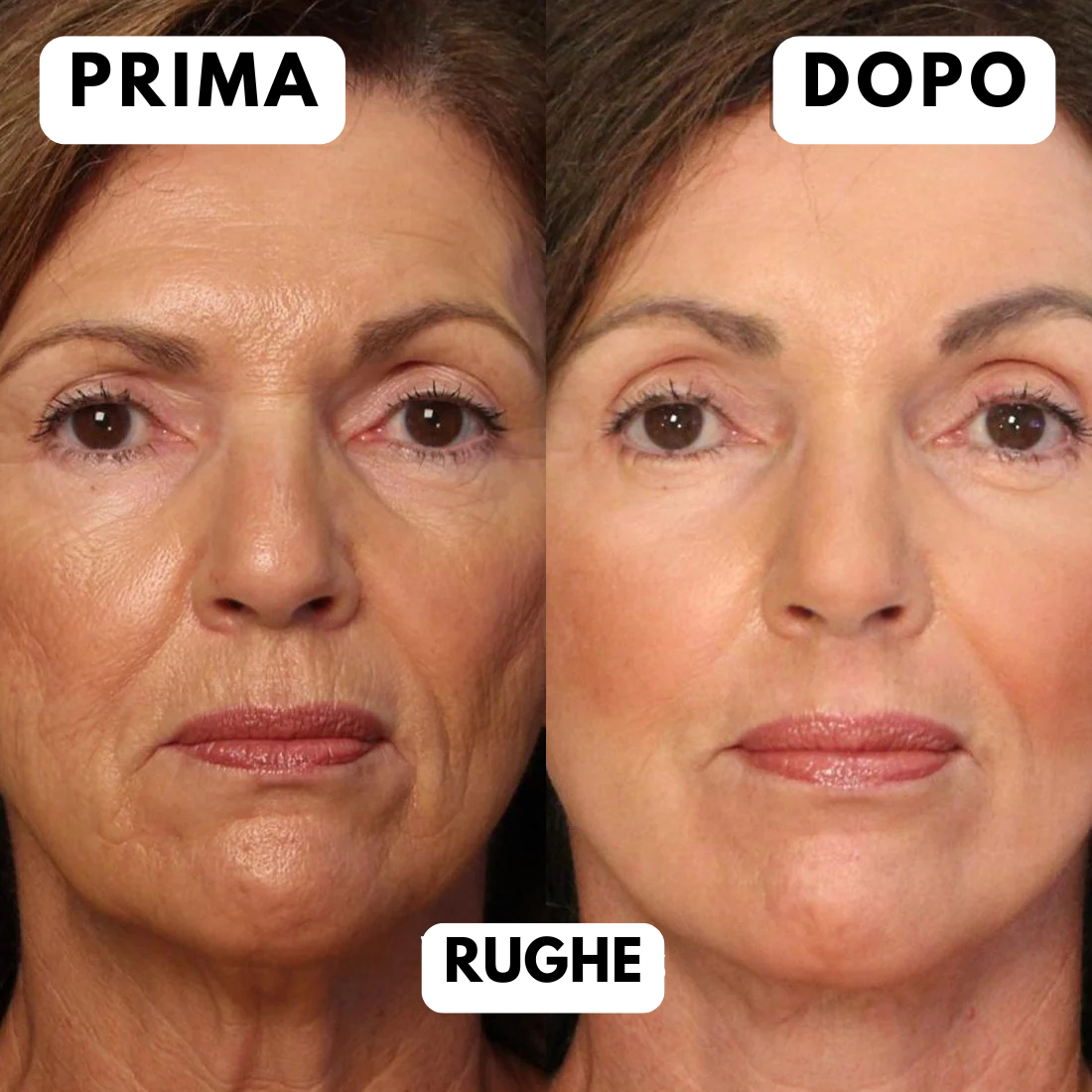 Offerta Black Friday-Maschera LED Viso Anti-Età