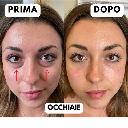 Offerta Black Friday-Maschera LED Viso Anti-Età